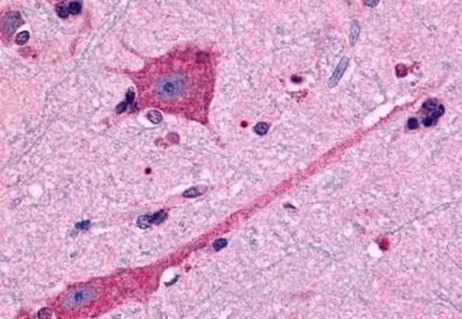 Immunohistochemistry (Formalin/PFA-fixed paraffin-embedded sections) - Anti-Dopamine D2 Receptor antibody (AB150532)