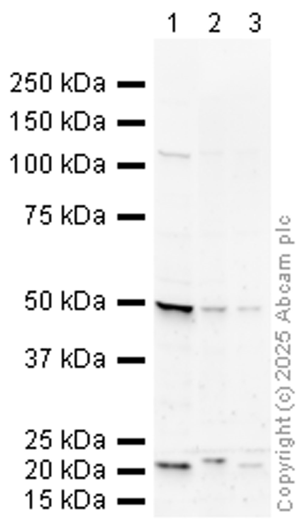 Western blot - Anti-Dopamine D2 Receptor antibody (AB85367)