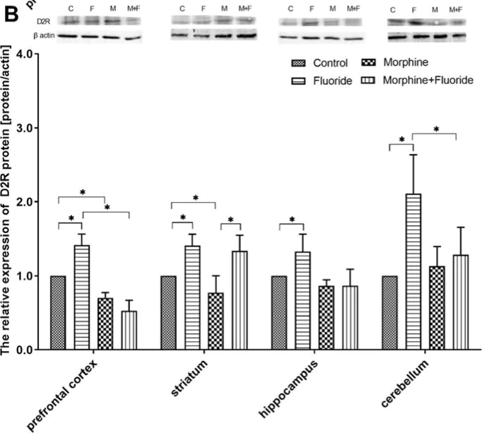 Western blot - Anti-Dopamine D2 Receptor antibody (AB85367)