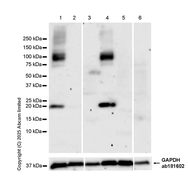Western blot - Anti-Dopamine D2 Receptor antibody [EPR30297-57] (AB324734)