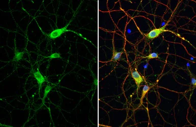 Immunocytochemistry/ Immunofluorescence - Anti-Dopamine D2 Receptor antibody [HL1478] - BSA and Azide free (AB313857)