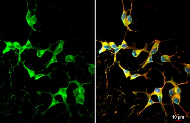 Immunocytochemistry/ Immunofluorescence - Anti-Dopamine D2 Receptor antibody [HL1478] - BSA and Azide free (AB313857)