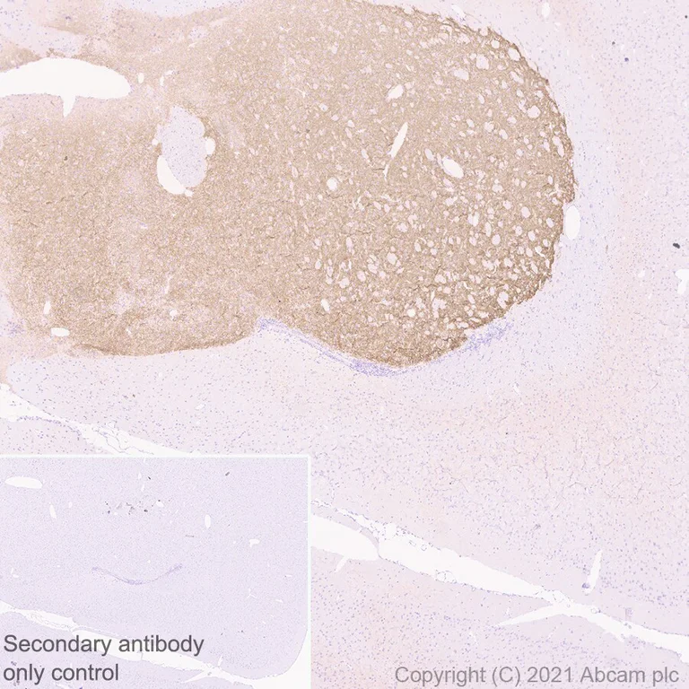 Immunohistochemistry (Formalin/PFA-fixed paraffin-embedded sections) - Anti-Dopamine Receptor D1 antibody [1-1-F11 s.E6] - BSA and Azide free (AB256556)