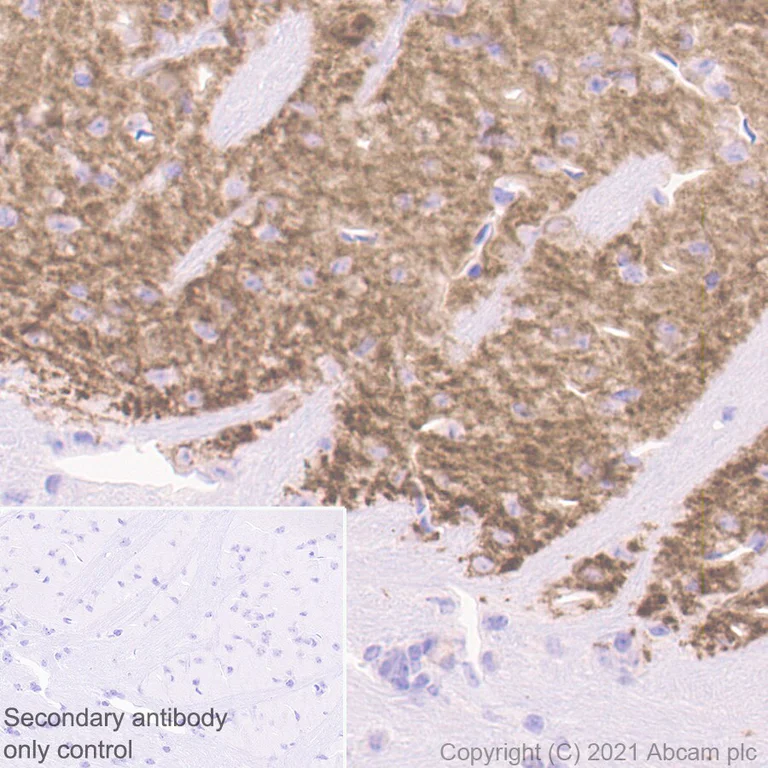 Immunohistochemistry (Formalin/PFA-fixed paraffin-embedded sections) - Anti-Dopamine Receptor D1 antibody [1-1-F11 s.E6] - BSA and Azide free (AB256556)