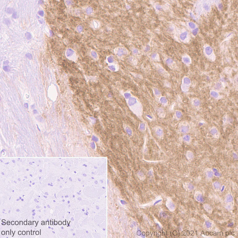 Immunohistochemistry (Formalin/PFA-fixed paraffin-embedded sections) - Anti-Dopamine Receptor D1 antibody [1-1-F11 s.E6] - BSA and Azide free (AB256556)