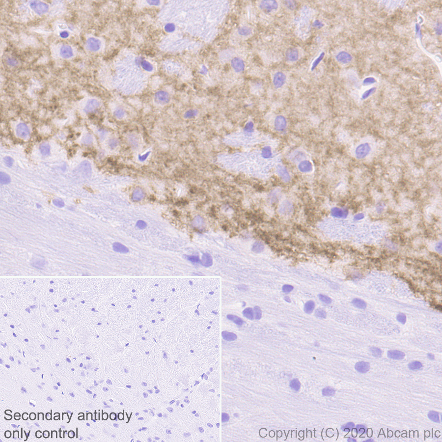 Immunohistochemistry (Formalin/PFA-fixed paraffin-embedded sections) - Anti-Dopamine Receptor D1 antibody [EPR24102-105] (ab279713), expandable thumbnail