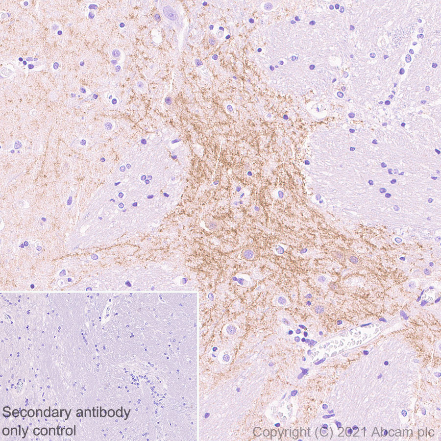 Immunohistochemistry (Formalin/PFA-fixed paraffin-embedded sections) - Anti-Dopamine Receptor D1 antibody [EPR24102-105] (AB279713), expandable thumbnail