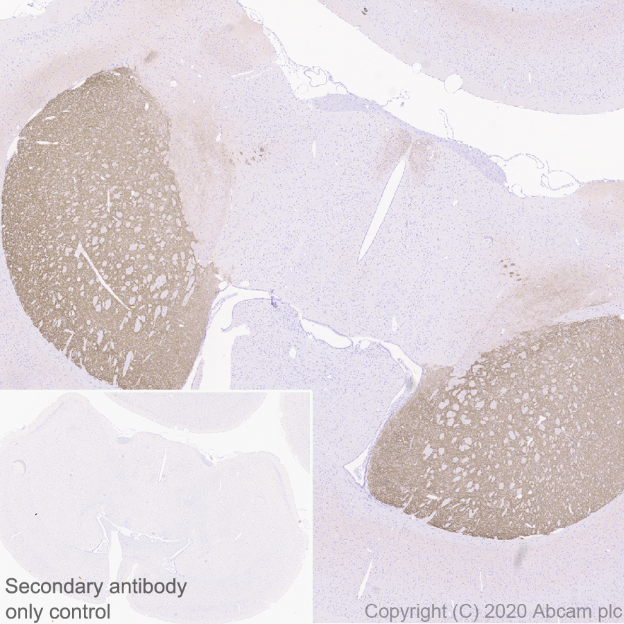 Immunohistochemistry (Formalin/PFA-fixed paraffin-embedded sections) - Anti-Dopamine Receptor D1 antibody [EPR24102-105] (ab279713), expandable thumbnail