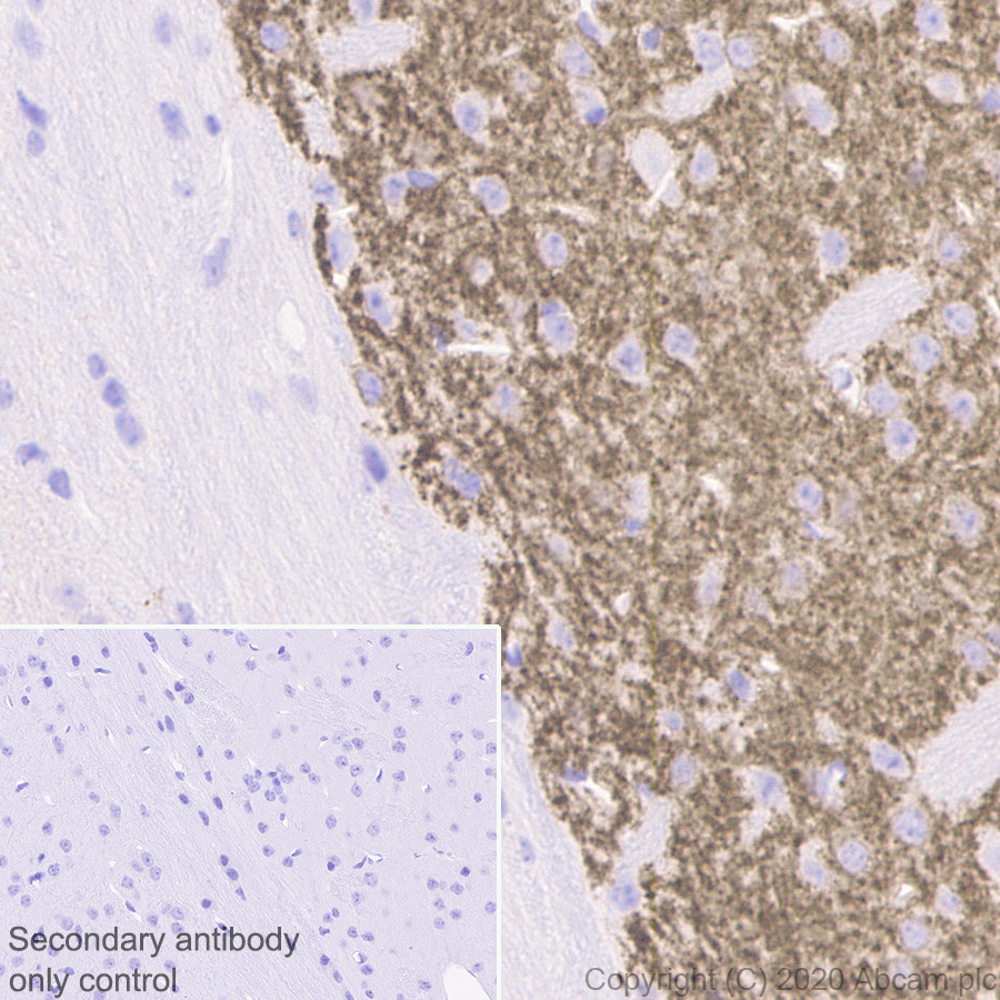 Immunohistochemistry (Formalin/PFA-fixed paraffin-embedded sections) - Anti-Dopamine Receptor D1 antibody [EPR24102-105] (ab279713), expandable thumbnail