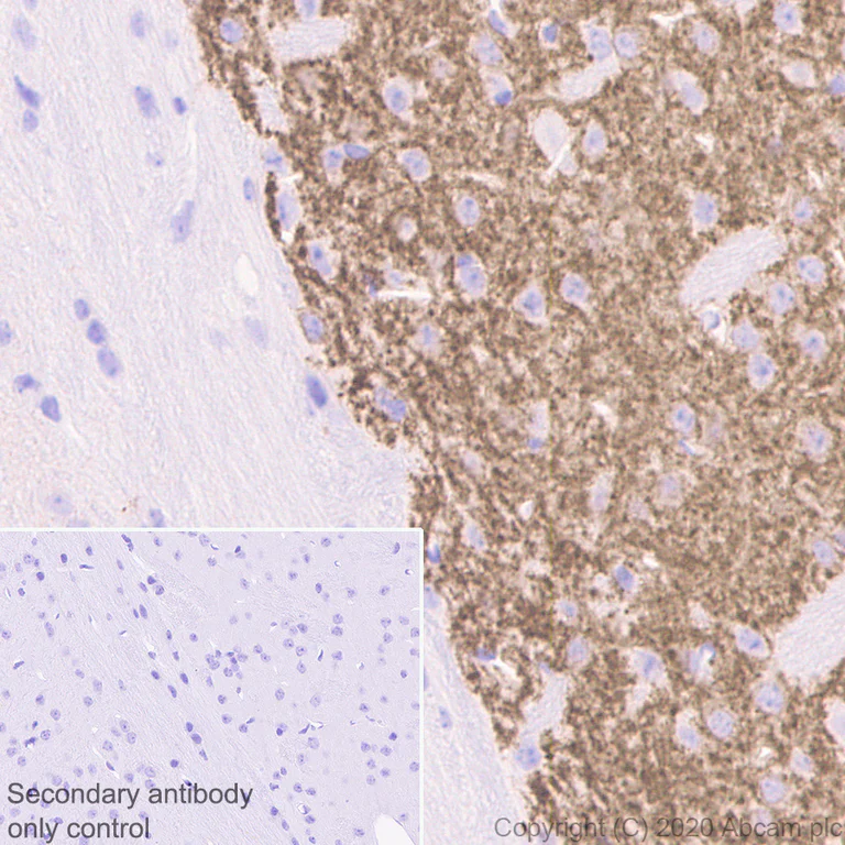 Immunohistochemistry (Formalin/PFA-fixed paraffin-embedded sections) - Anti-Dopamine Receptor D1 antibody [EPR24102-105] (AB279713)