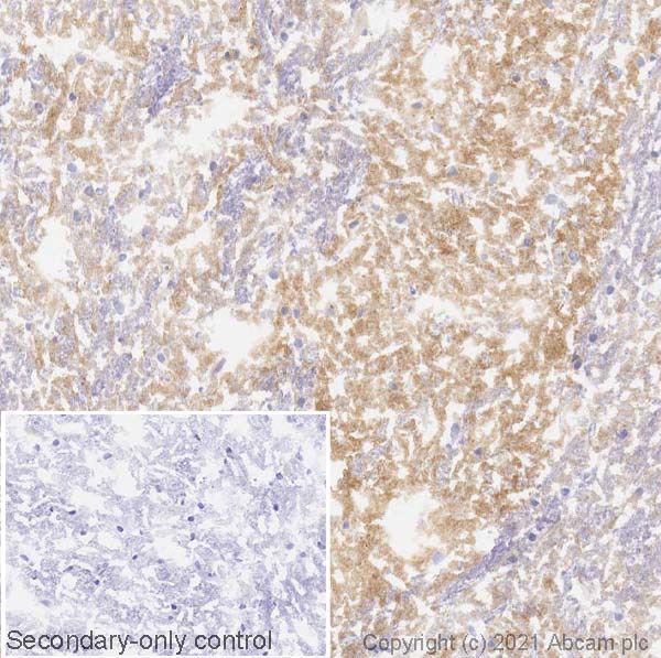 Immunohistochemistry (Frozen sections) - Anti-Dopamine Receptor D1 antibody [EPR24102-105] (AB279713), expandable thumbnail