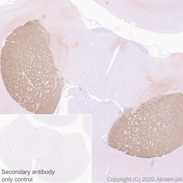 Immunohistochemistry (Formalin/PFA-fixed paraffin-embedded sections) - Anti-Dopamine Receptor D1 antibody [EPR24102-105] - BSA and Azide free (AB279718)