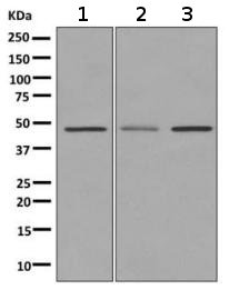 Western blot - Anti-Dopamine Receptor D3/DRD3 antibody [EPR10148] (AB155098), expandable thumbnail