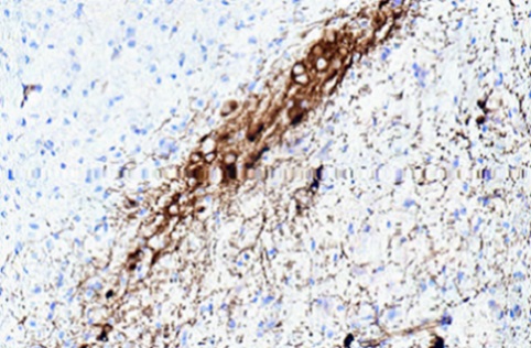 Immunohistochemistry (Formalin/PFA-fixed paraffin-embedded sections) - Anti-Dopamine Transporter antibody [6V-23-23] (AB128848), expandable thumbnail