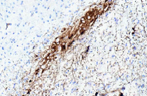 Immunohistochemistry (Formalin/PFA-fixed paraffin-embedded sections) - Anti-Dopamine Transporter antibody [6V-23-23] (AB128848)