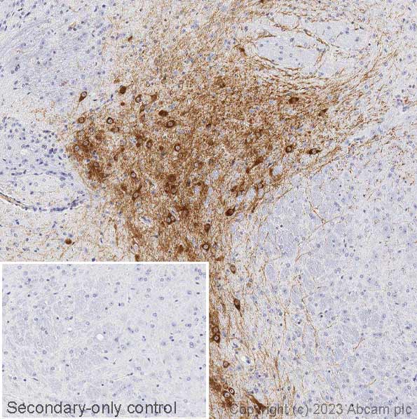 Immunohistochemistry (Formalin/PFA-fixed paraffin-embedded sections) - Anti-Dopamine Transporter antibody [6V-23-23] (AB128848), expandable thumbnail