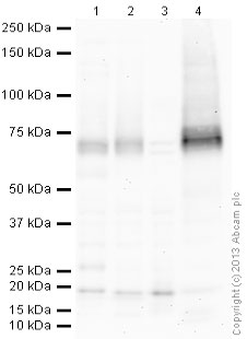 Western blot - Anti-Dopamine Transporter antibody [6V-23-23] (AB128848), expandable thumbnail