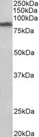 Western blot - Anti-Dopamine Transporter antibody (AB130140), expandable thumbnail