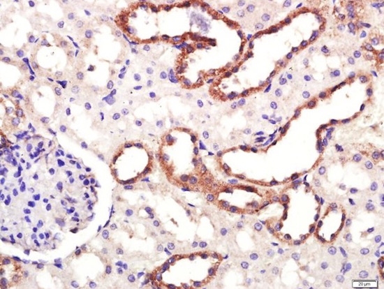 Immunohistochemistry (Formalin/PFA-fixed paraffin-embedded sections) - Anti-Dopamine Transporter antibody (AB214470), expandable thumbnail