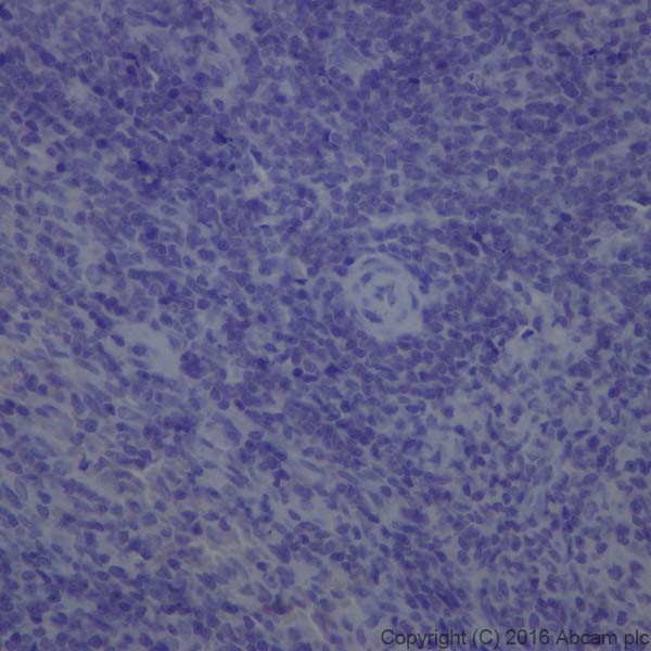 Immunohistochemistry (Formalin/PFA-fixed paraffin-embedded sections) - Anti-Dopamine Transporter antibody [EPR19695] (ab184451), expandable thumbnail