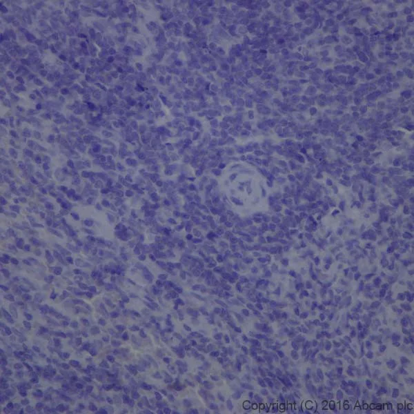 Immunohistochemistry (Formalin/PFA-fixed paraffin-embedded sections) - Anti-Dopamine Transporter antibody [EPR19695] (AB184451)