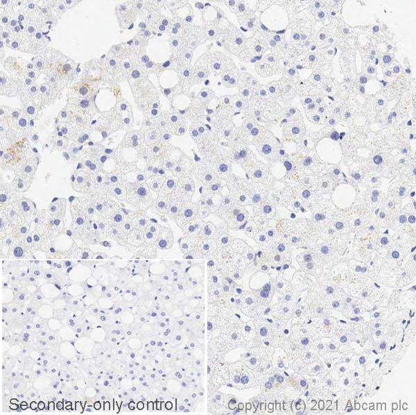 Immunohistochemistry (Formalin/PFA-fixed paraffin-embedded sections) - Anti-Dopamine Transporter antibody [EPR19695] (AB184451), expandable thumbnail