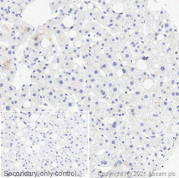 Immunohistochemistry (Formalin/PFA-fixed paraffin-embedded sections) - Anti-Dopamine Transporter antibody [EPR19695] (AB184451)