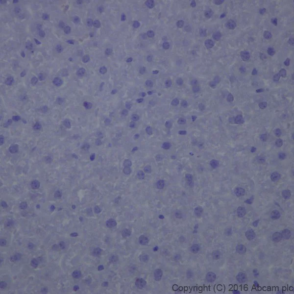 Immunohistochemistry (Formalin/PFA-fixed paraffin-embedded sections) - Anti-Dopamine Transporter antibody [EPR19695] (AB184451)