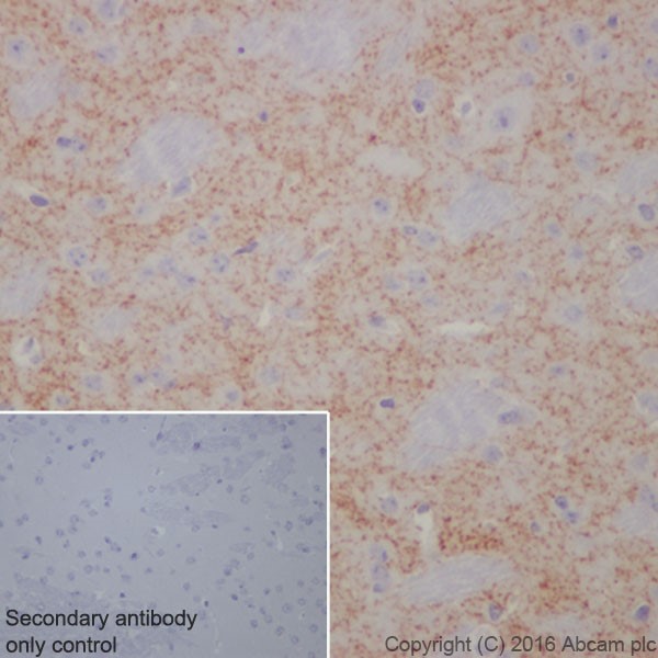 Immunohistochemistry (Formalin/PFA-fixed paraffin-embedded sections) - Anti-Dopamine Transporter antibody [EPR19695] (ab184451), expandable thumbnail