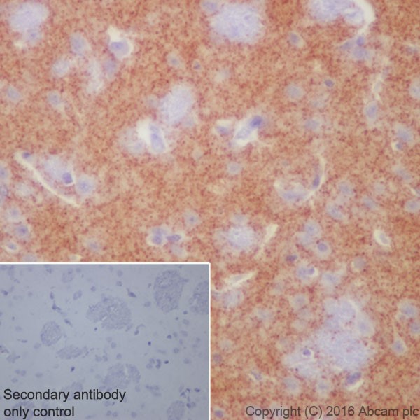 Immunohistochemistry (Formalin/PFA-fixed paraffin-embedded sections) - Anti-Dopamine Transporter antibody [EPR19695] (ab184451), expandable thumbnail