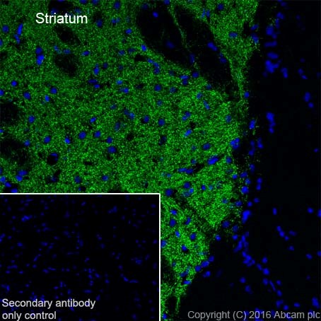 Immunohistochemistry (Frozen sections) - Anti-Dopamine Transporter antibody [EPR19695] (ab184451), expandable thumbnail