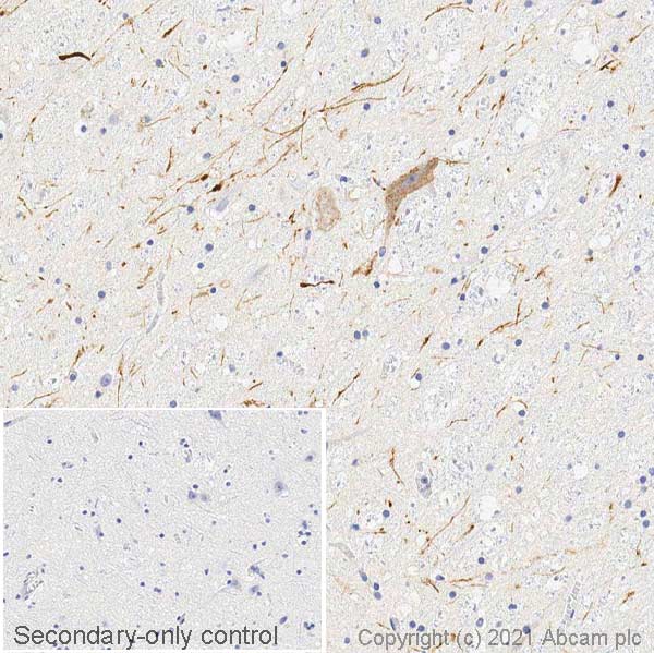 Immunohistochemistry (Frozen sections) - Anti-Dopamine Transporter antibody [EPR19695] (AB184451), expandable thumbnail
