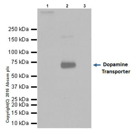 Immunoprecipitation - Anti-Dopamine Transporter antibody [EPR19695] (ab184451), expandable thumbnail