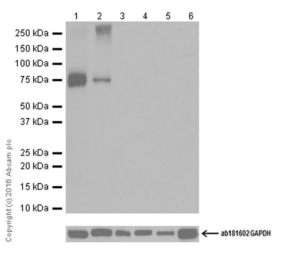 Western blot - Anti-Dopamine Transporter antibody [EPR19695] (AB184451), expandable thumbnail