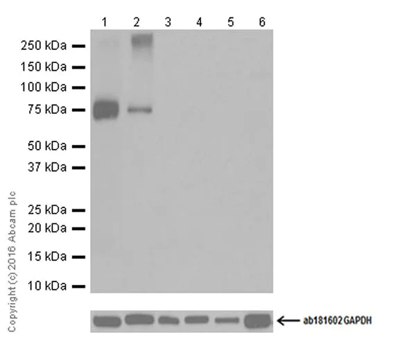 Western blot - Anti-Dopamine Transporter antibody [EPR19695] (AB184451)