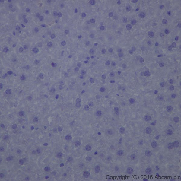 Immunohistochemistry (Formalin/PFA-fixed paraffin-embedded sections) - Anti-Dopamine Transporter antibody [EPR19695] - BSA and Azide free (ab221845), expandable thumbnail