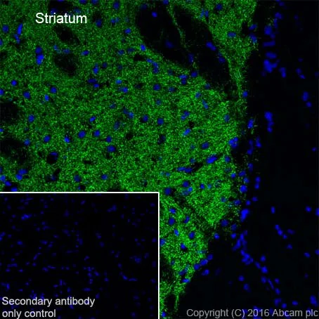 Immunohistochemistry (Frozen sections) - Anti-Dopamine Transporter antibody [EPR19695] - BSA and Azide free (AB221845)