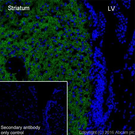 Immunohistochemistry (Frozen sections) - Anti-Dopamine Transporter antibody [EPR19695] - BSA and Azide free (AB221845)