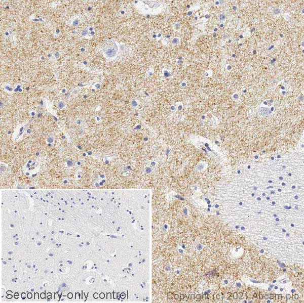 Immunohistochemistry (Frozen sections) - Anti-Dopamine Transporter antibody [EPR19695] - BSA and Azide free (AB221845)