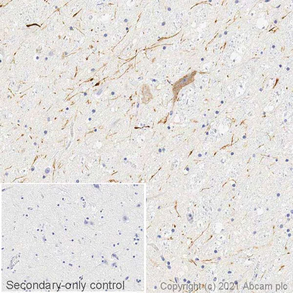 Immunohistochemistry (Frozen sections) - Anti-Dopamine Transporter antibody [EPR19695] - BSA and Azide free (AB221845)