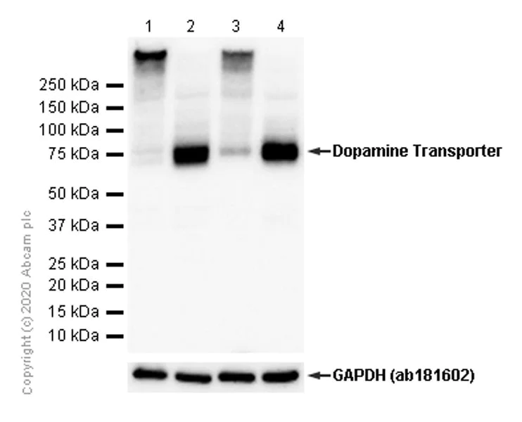 Western blot - Anti-Dopamine Transporter antibody [EPR19695] - BSA and Azide free (AB221845)
