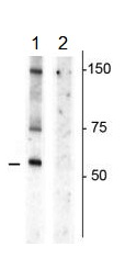 Western blot - Anti-Dopamine Transporter (phospho T53) antibody (AB183486), expandable thumbnail