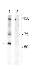 Western blot - Anti-Dopamine Transporter (phospho T53) antibody (AB183486)