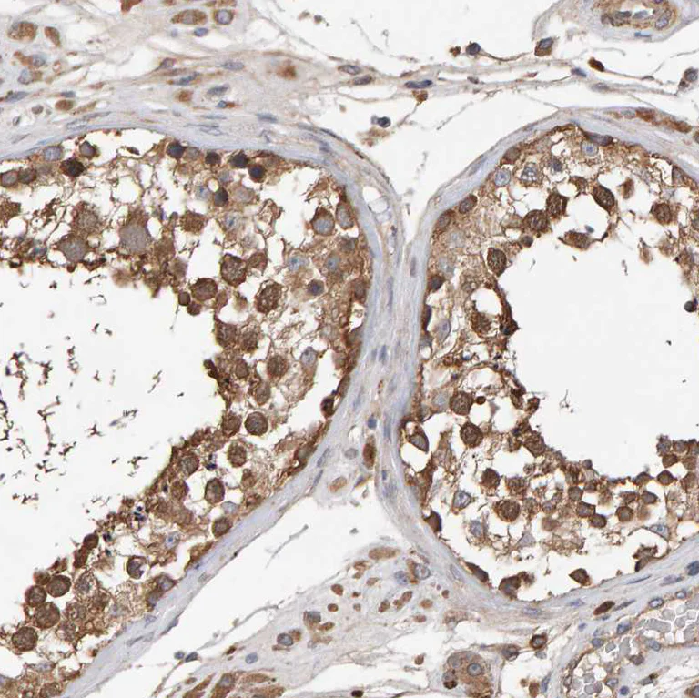 Immunohistochemistry (Formalin/PFA-fixed paraffin-embedded sections) - Anti-DORFIN antibody (AB251750)