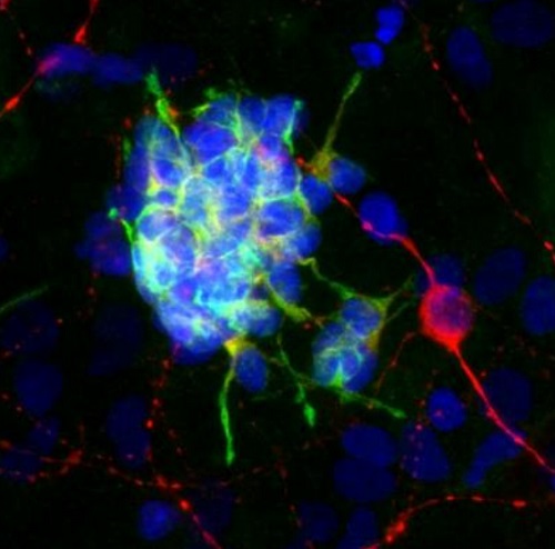 Immunocytochemistry/ Immunofluorescence - Anti-Doublecortin antibody [3E1] (AB254133), expandable thumbnail