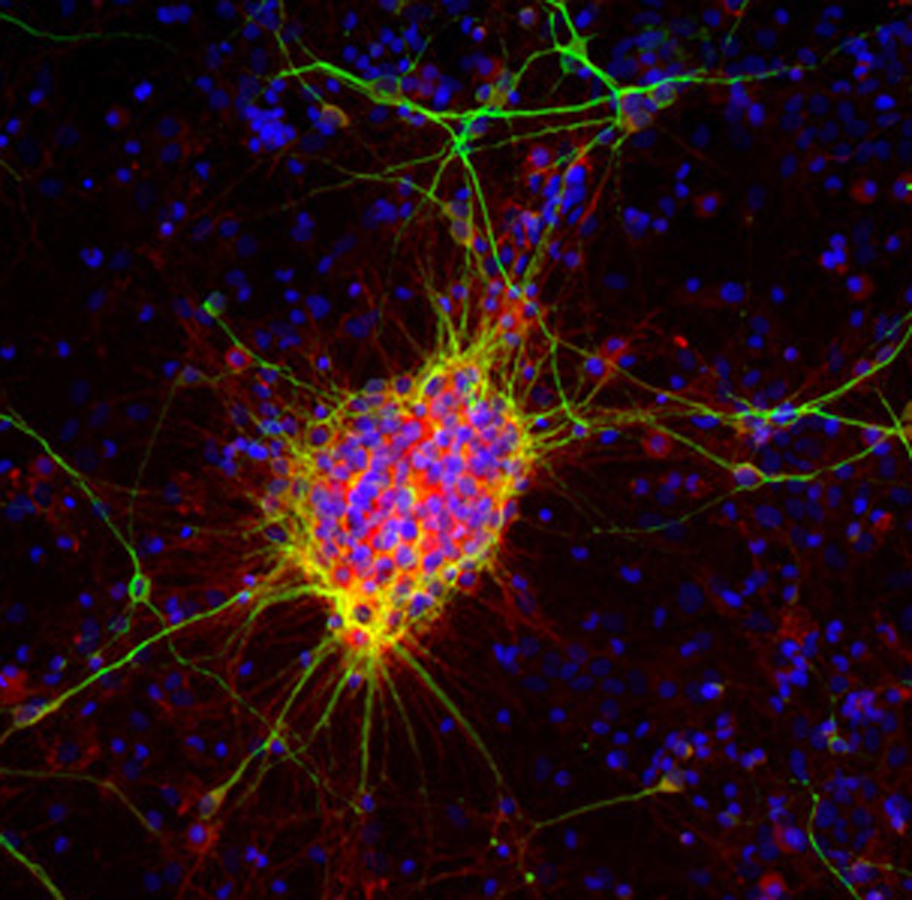 Immunocytochemistry/ Immunofluorescence - Anti-Doublecortin antibody [3E1] (AB254133), expandable thumbnail