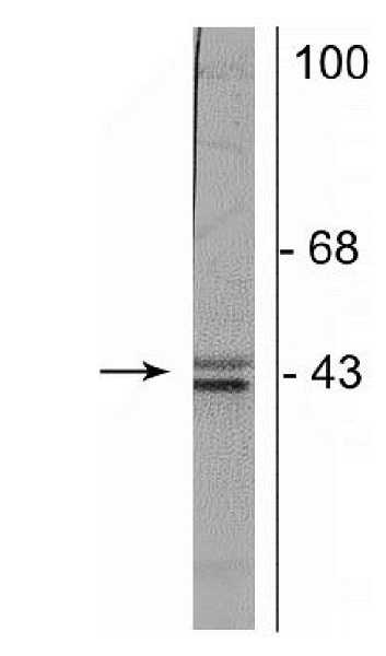 Western blot - Anti-Doublecortin antibody [3E1] (AB254133), expandable thumbnail