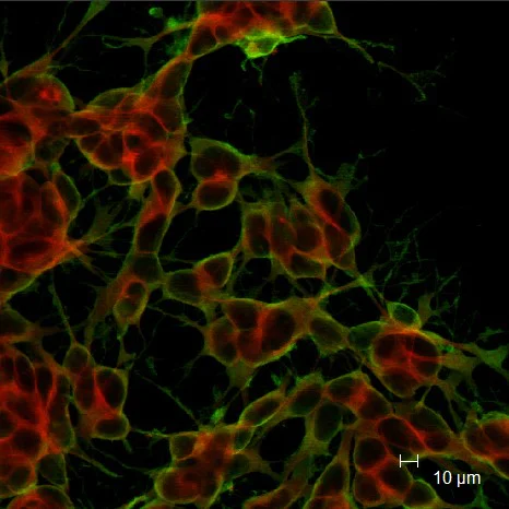 Immunocytochemistry/ Immunofluorescence - Anti-Doublecortin antibody (AB153668)