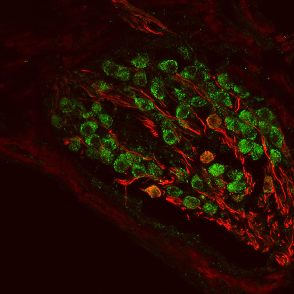 Immunohistochemistry (Formalin/PFA-fixed paraffin-embedded sections) - Anti-Doublecortin antibody (AB153668)