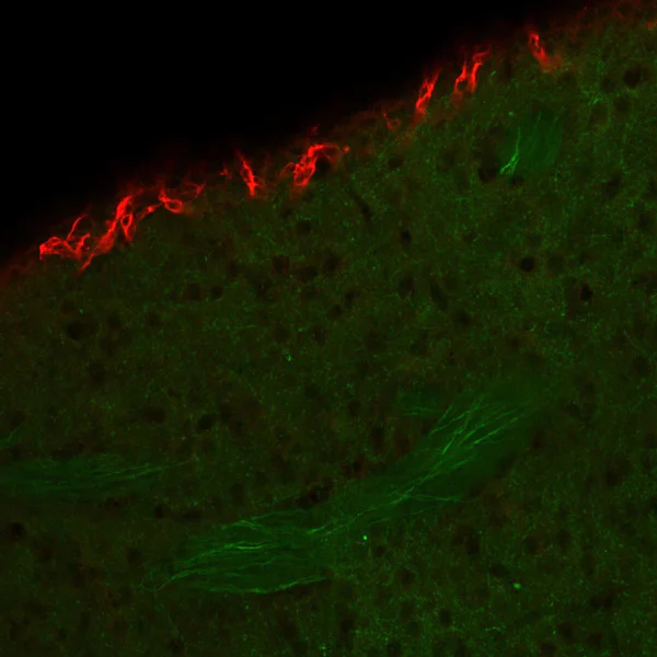 Immunohistochemistry (Formalin/PFA-fixed paraffin-embedded sections) - Anti-Doublecortin antibody (AB153668)